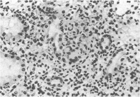 https://cdn.ncbi.nlm.nih.gov/pmc/blobs/9479/1687565/04181a98899b/brmedj00531-0029-a.jpg