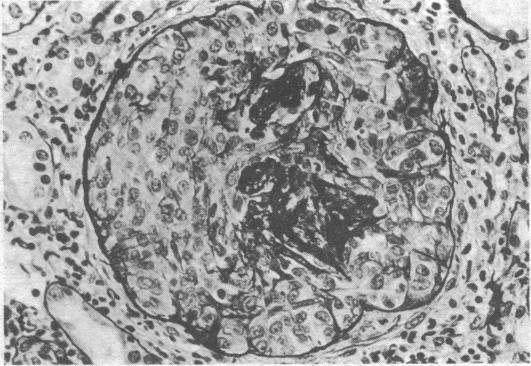 https://cdn.ncbi.nlm.nih.gov/pmc/blobs/9479/1687565/9d3466f4333b/brmedj00531-0028-a.jpg