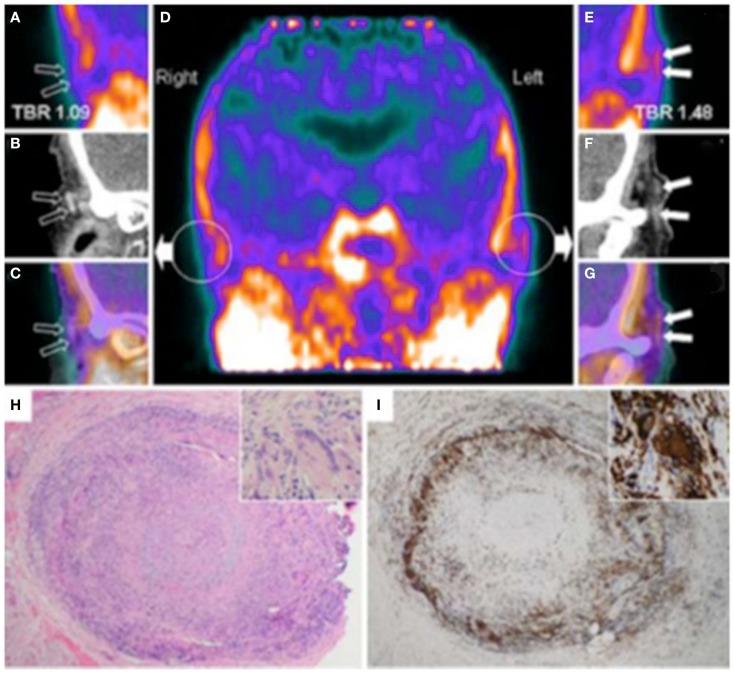 https://cdn.ncbi.nlm.nih.gov/pmc/blobs/947a/4135304/4d58bf51a364/fimmu-05-00399-g004.jpg