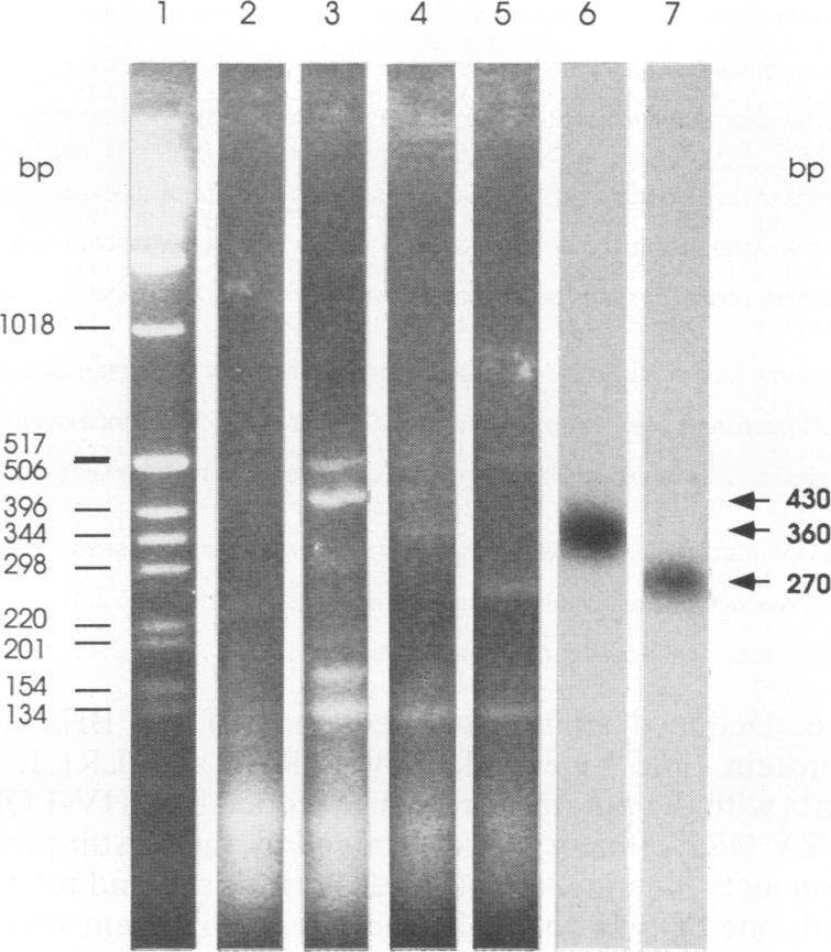 https://cdn.ncbi.nlm.nih.gov/pmc/blobs/947c/237501/6cf4f511dfcd/jvirol00024-0209-a.jpg