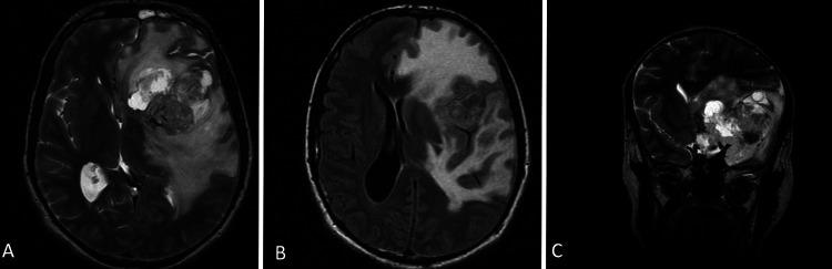 https://cdn.ncbi.nlm.nih.gov/pmc/blobs/9488/9379713/3a49caf05791/CASE21630f1.jpg