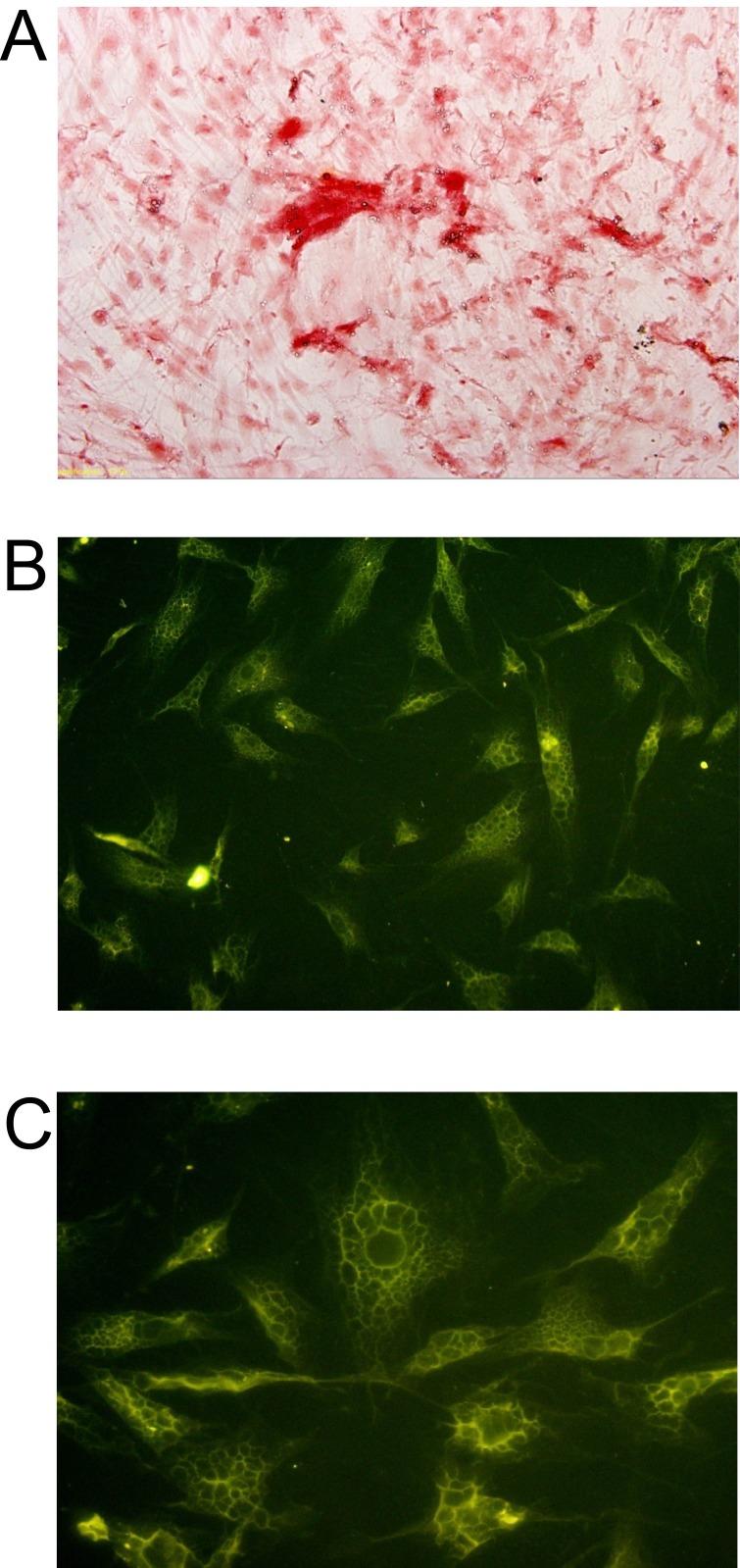 https://cdn.ncbi.nlm.nih.gov/pmc/blobs/948b/5617506/6cc5f4166bf9/oncotarget-08-62298-g006.jpg
