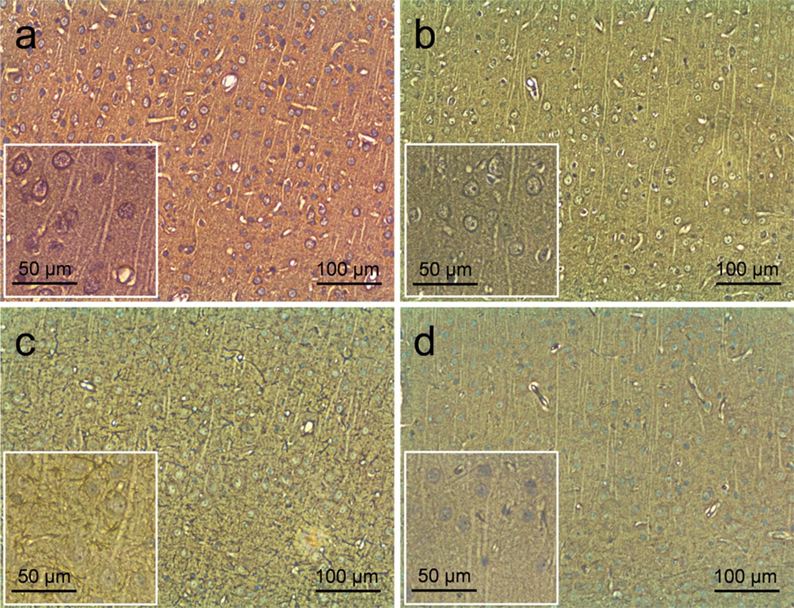 https://cdn.ncbi.nlm.nih.gov/pmc/blobs/948d/6146769/1be96d8f090e/12868_2018_459_Fig5_HTML.jpg