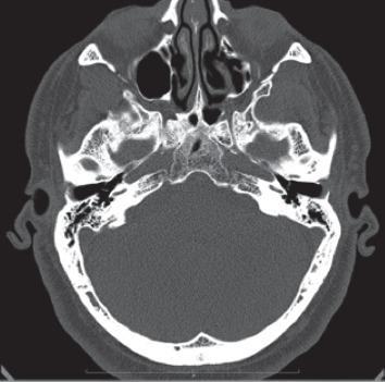 https://cdn.ncbi.nlm.nih.gov/pmc/blobs/9491/7149419/a812f91cc42a/CRIM2020-1710271.001.jpg