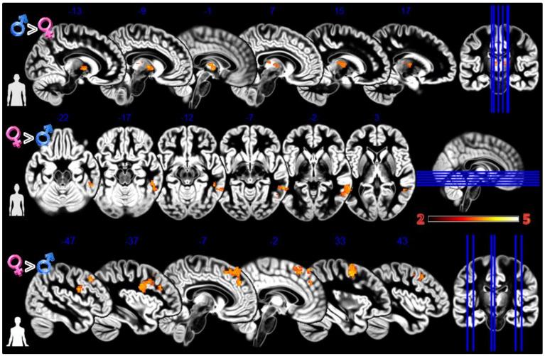 https://cdn.ncbi.nlm.nih.gov/pmc/blobs/9491/9416062/f6409a29bb7a/tomography-08-00176-g003.jpg
