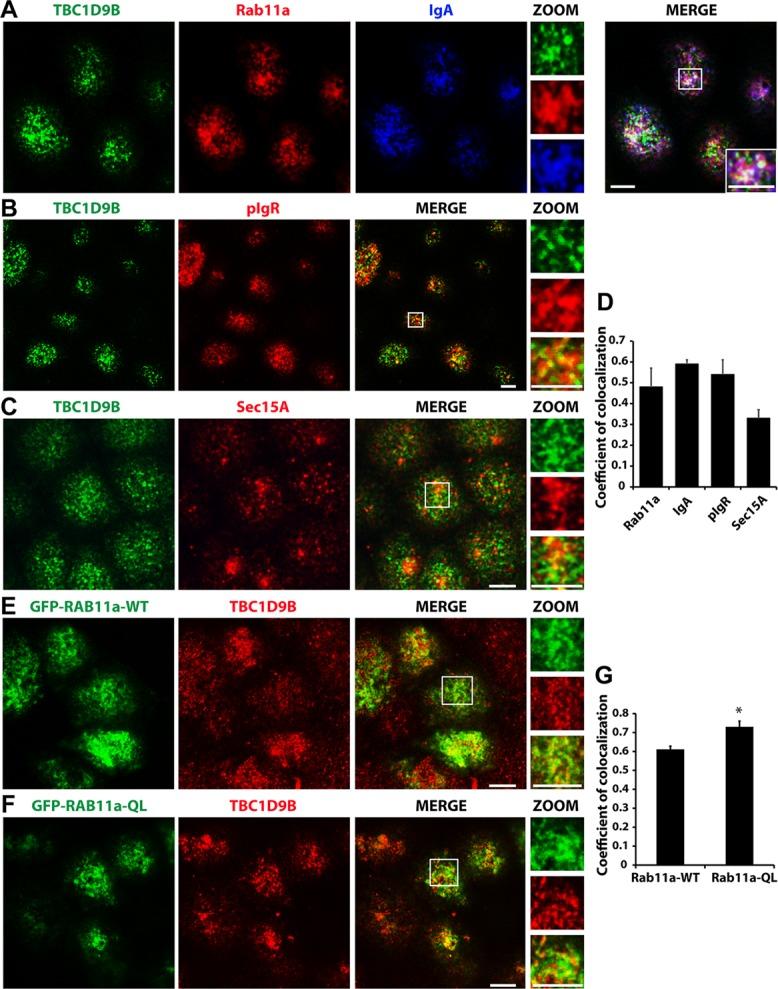 https://cdn.ncbi.nlm.nih.gov/pmc/blobs/9498/4230784/16e753732a62/3779fig7.jpg