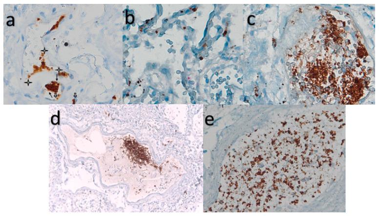 https://cdn.ncbi.nlm.nih.gov/pmc/blobs/949a/11120208/6a882d47d7f3/cells-13-00854-g001.jpg