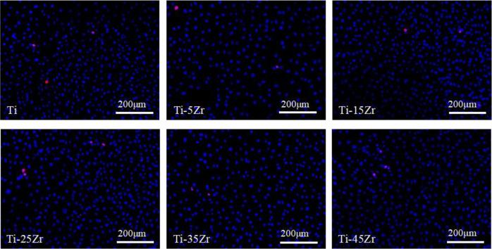 https://cdn.ncbi.nlm.nih.gov/pmc/blobs/949b/8064977/9c5c9d77bdc2/10856_2021_6522_Fig1_HTML.jpg