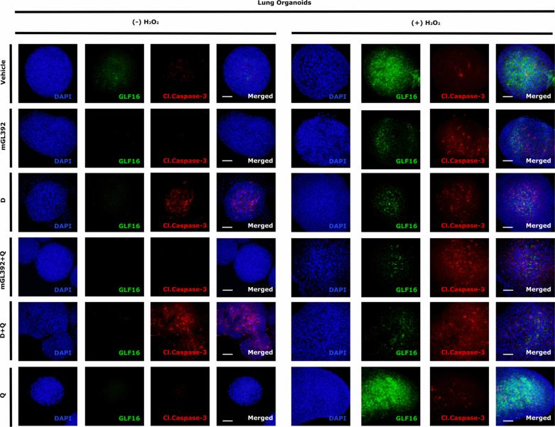 https://cdn.ncbi.nlm.nih.gov/pmc/blobs/94a2/11754095/0fe3e04aa065/43587_2024_747_Fig11_ESM.jpg