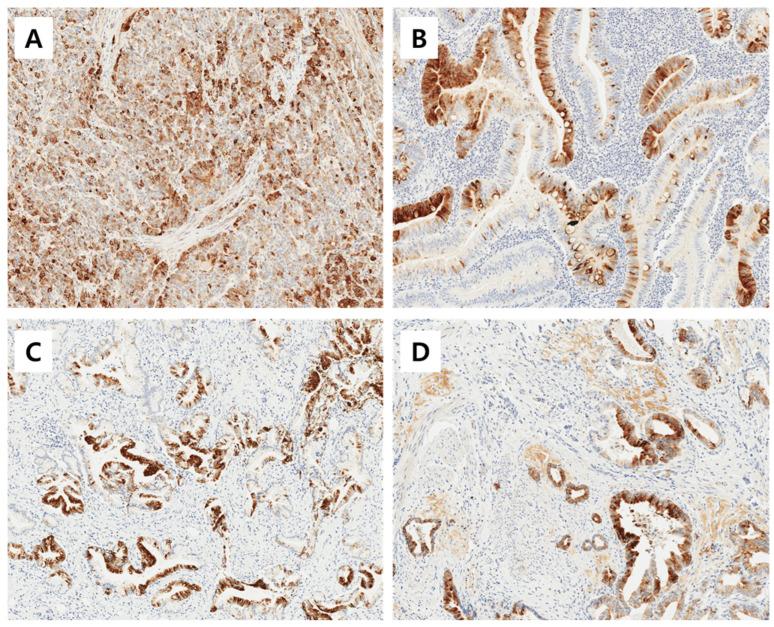https://cdn.ncbi.nlm.nih.gov/pmc/blobs/94a3/11171239/0b76b8020796/cancers-16-02120-g001.jpg