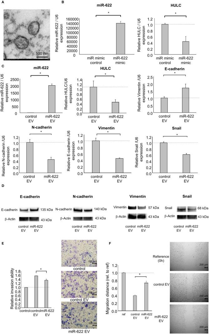 https://cdn.ncbi.nlm.nih.gov/pmc/blobs/94a3/7324724/3ff4916fa7aa/fonc-10-01013-g0006.jpg