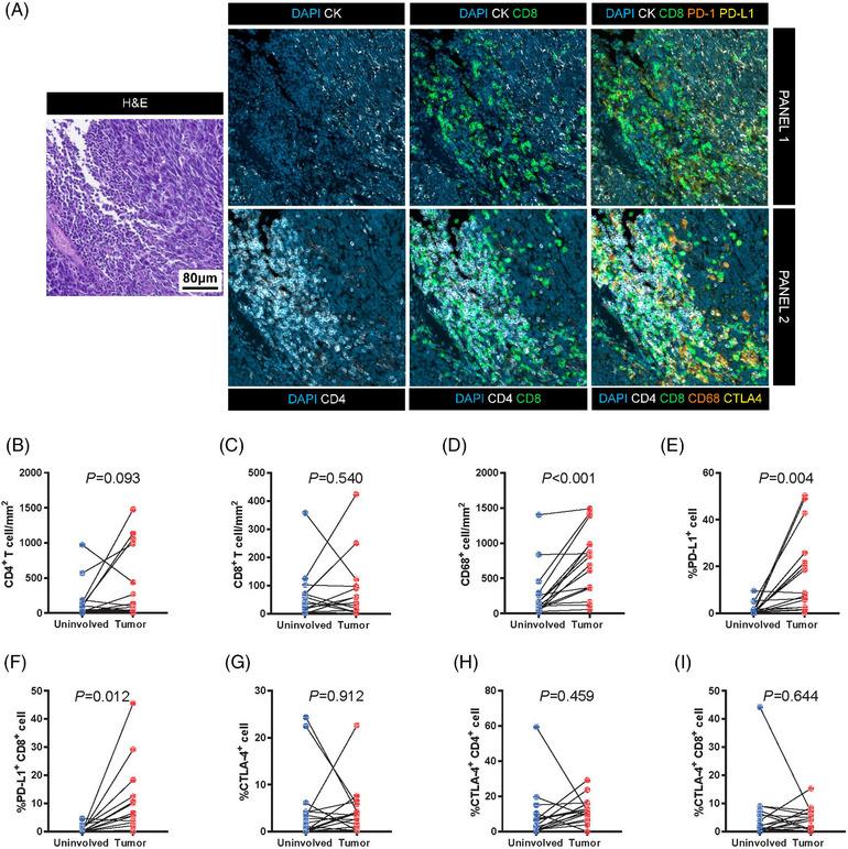 https://cdn.ncbi.nlm.nih.gov/pmc/blobs/94b3/10542987/ecd74f89cb20/MCO2-4-e370-g006.jpg