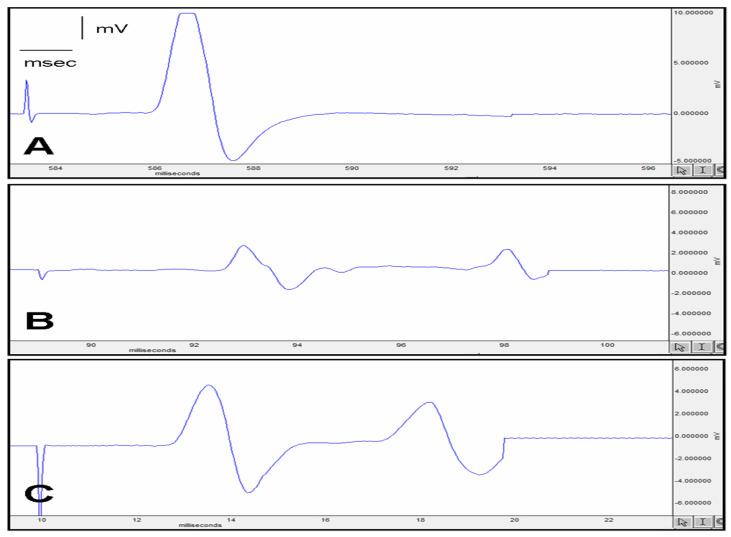 https://cdn.ncbi.nlm.nih.gov/pmc/blobs/94b4/10573691/ee8fbf9e9194/jcm-12-06411-g002.jpg