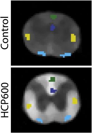 https://cdn.ncbi.nlm.nih.gov/pmc/blobs/94ba/3777678/895b7564e421/gr1.jpg