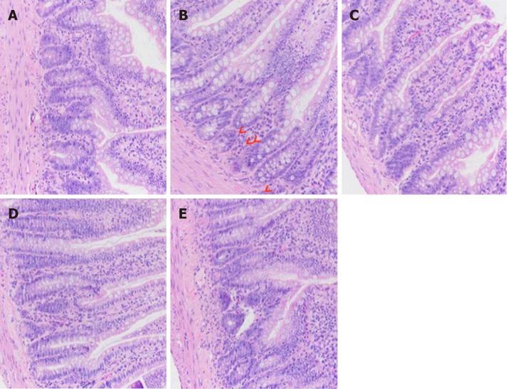 https://cdn.ncbi.nlm.nih.gov/pmc/blobs/94bc/6689801/b3d897c126d4/WJG-25-3956-g002.jpg
