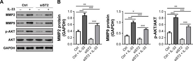 https://cdn.ncbi.nlm.nih.gov/pmc/blobs/94c1/5820469/cbcc34bf6f71/ott-11-843Fig4.jpg
