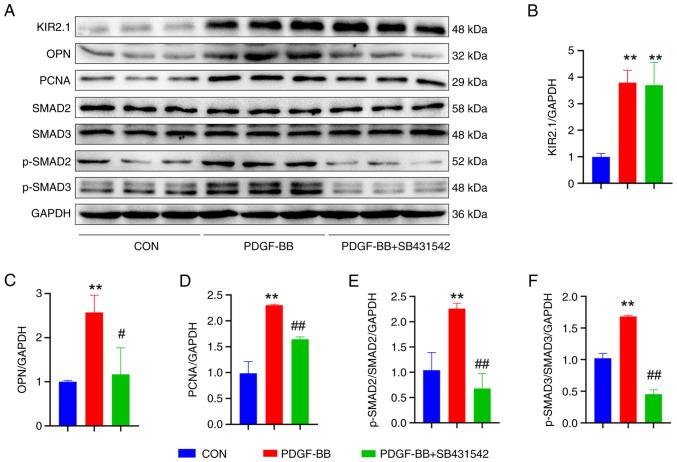 https://cdn.ncbi.nlm.nih.gov/pmc/blobs/94c2/9354699/4811e9498cf6/IJMM-50-3-05175-g05.jpg
