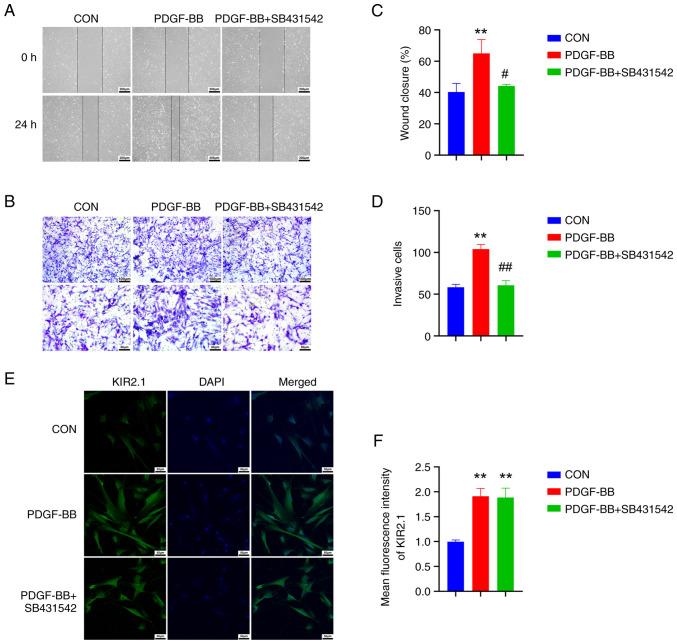https://cdn.ncbi.nlm.nih.gov/pmc/blobs/94c2/9354699/c8db0bc42597/IJMM-50-3-05175-g04.jpg
