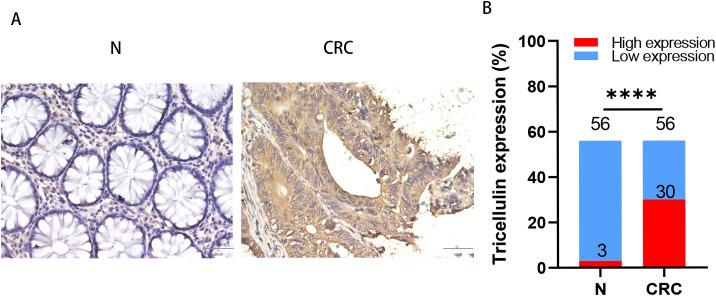 https://cdn.ncbi.nlm.nih.gov/pmc/blobs/94c8/12021625/888185e5103e/fonc-15-1562976-g001.jpg