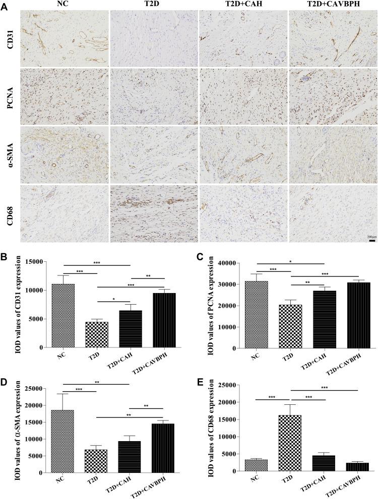 https://cdn.ncbi.nlm.nih.gov/pmc/blobs/94d2/9427019/d42ce20f63fa/JIR-15-4921-g0006.jpg
