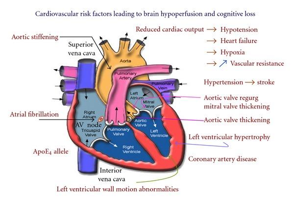 https://cdn.ncbi.nlm.nih.gov/pmc/blobs/94d4/3518077/9ba633d69f05/CPN2012-367516.001.jpg