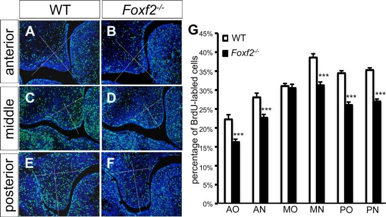 https://cdn.ncbi.nlm.nih.gov/pmc/blobs/94d5/4712829/2744f928ec3a/pgen.1005769.g002.jpg