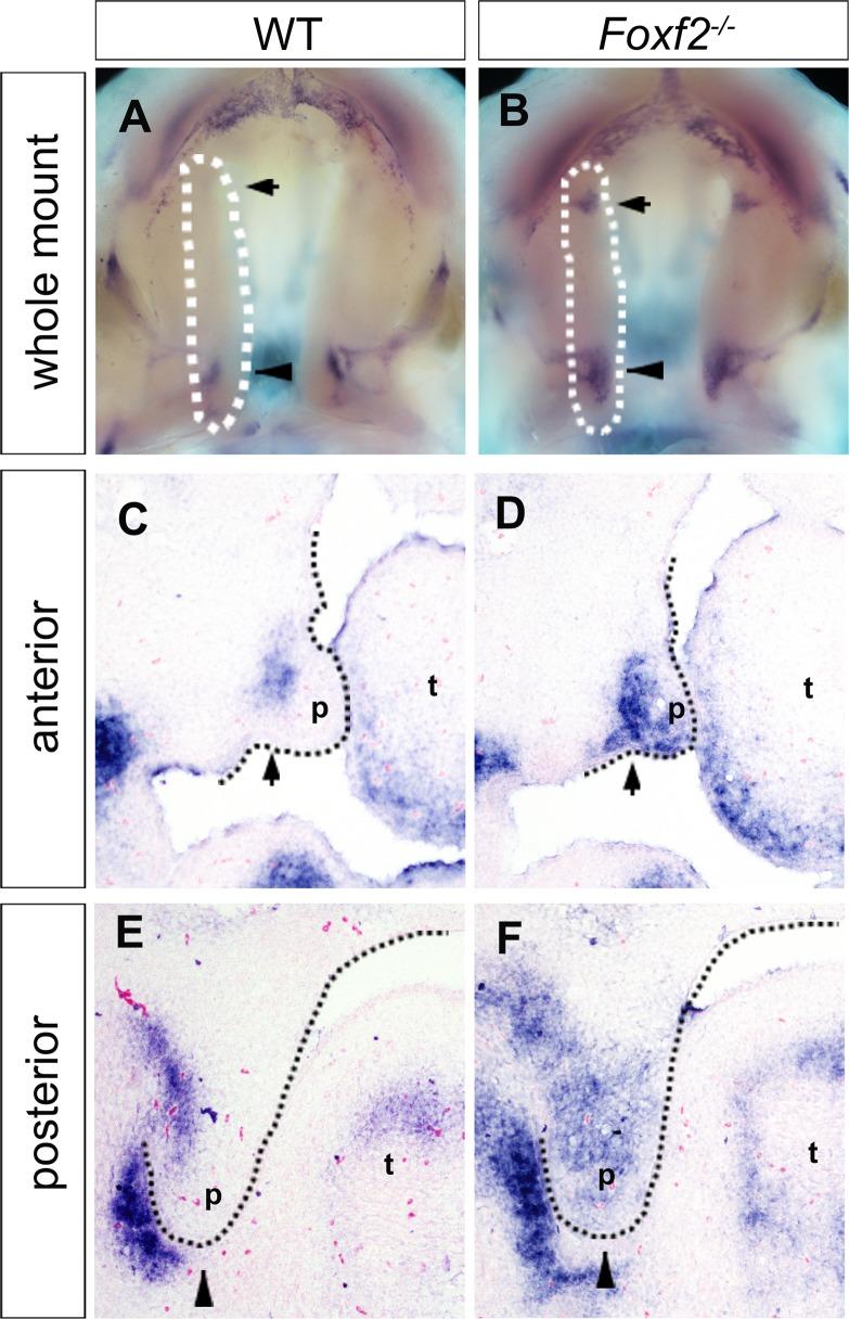 https://cdn.ncbi.nlm.nih.gov/pmc/blobs/94d5/4712829/3698a074ec8d/pgen.1005769.g005.jpg