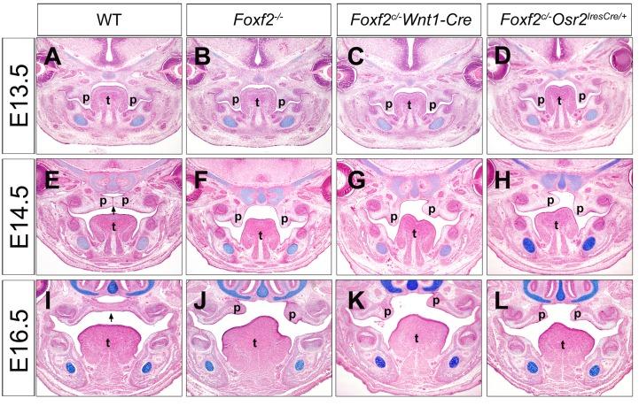 https://cdn.ncbi.nlm.nih.gov/pmc/blobs/94d5/4712829/9e0265a7e8e1/pgen.1005769.g001.jpg