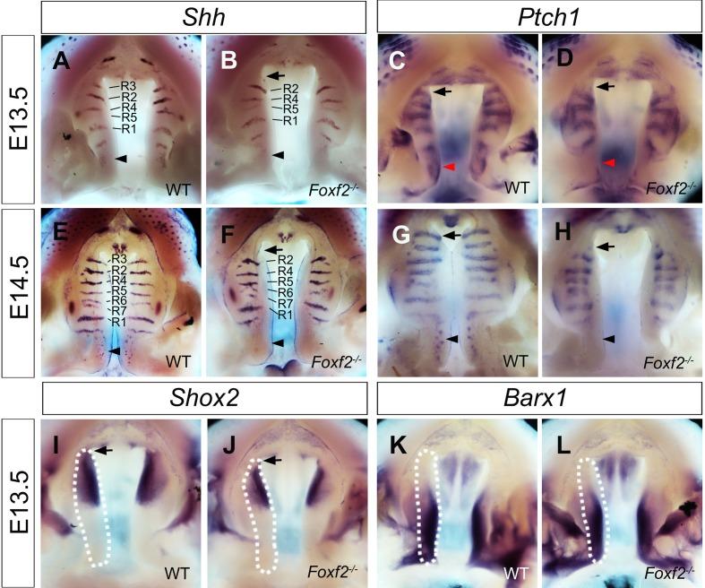 https://cdn.ncbi.nlm.nih.gov/pmc/blobs/94d5/4712829/e23646e4ab30/pgen.1005769.g003.jpg