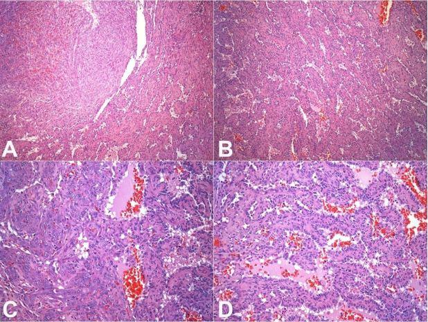 https://cdn.ncbi.nlm.nih.gov/pmc/blobs/94d8/6629266/fe94914497d5/autopsy-09-03e2019100-g03.jpg