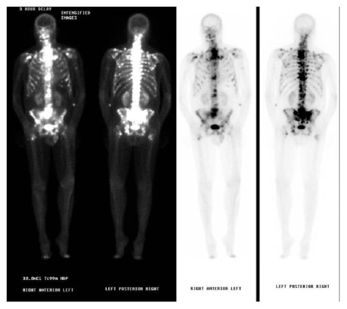 https://cdn.ncbi.nlm.nih.gov/pmc/blobs/94dd/6633922/8374d4b1a3e2/CRIPU2019-9387021.005.jpg
