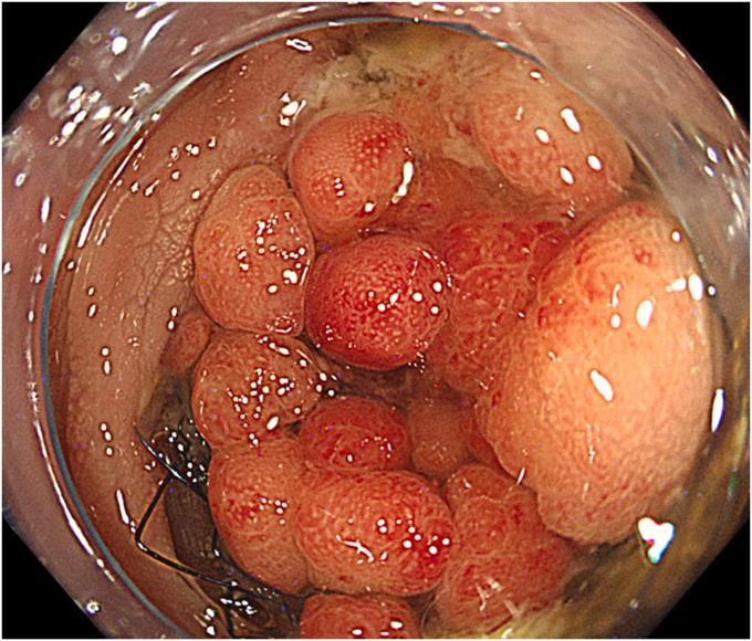 https://cdn.ncbi.nlm.nih.gov/pmc/blobs/94e0/10751453/8b37a15ddfb2/gr2.jpg