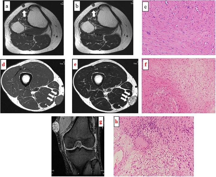 https://cdn.ncbi.nlm.nih.gov/pmc/blobs/94ee/6312209/dd5b8c588c9b/pone.0209642.g001.jpg