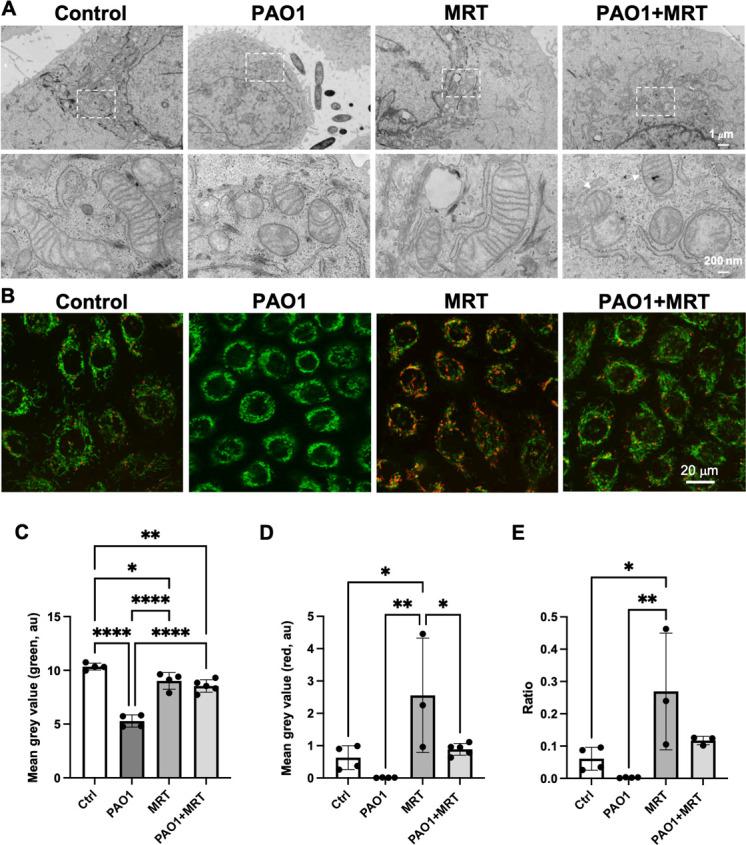 https://cdn.ncbi.nlm.nih.gov/pmc/blobs/94ef/11852725/3458a6a9bdbe/msphere.00537-24.f006.jpg