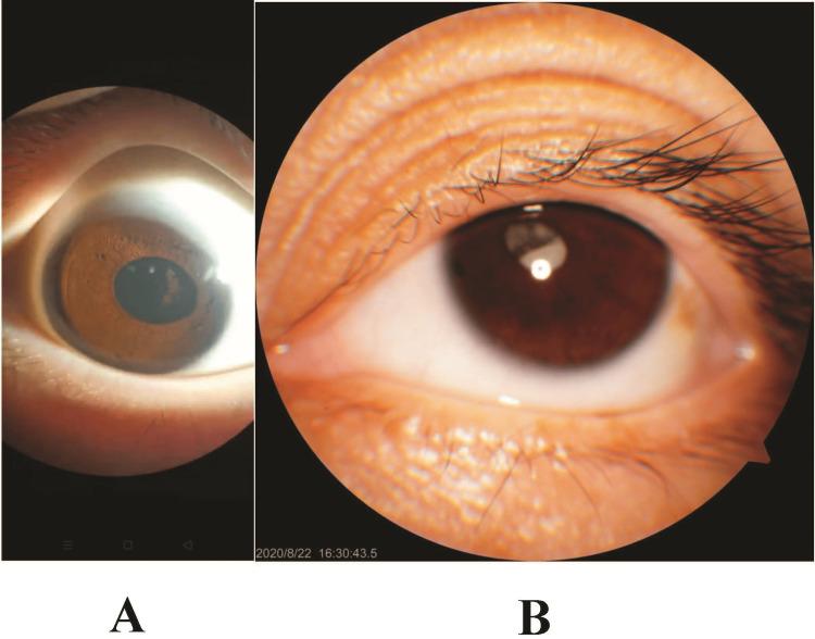https://cdn.ncbi.nlm.nih.gov/pmc/blobs/94f0/9957680/662a84d9e753/cureus-0015-00000034208-i03.jpg