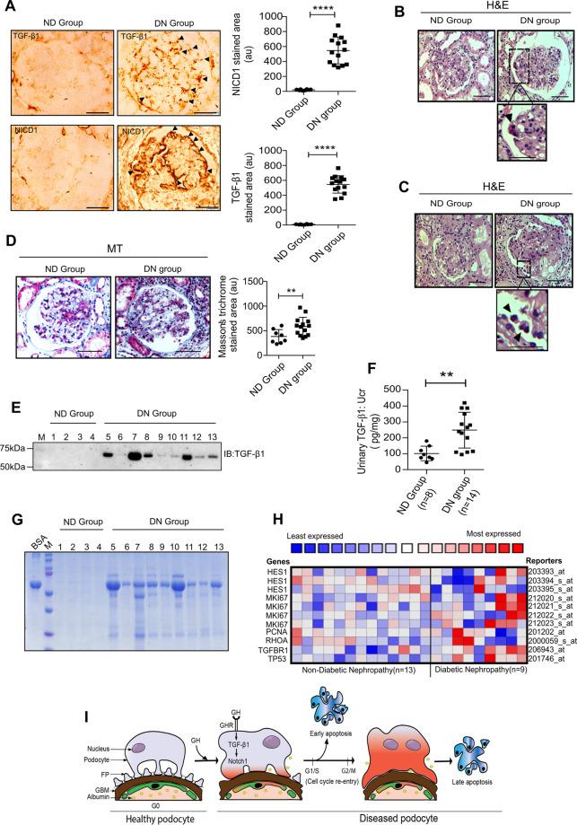https://cdn.ncbi.nlm.nih.gov/pmc/blobs/94f3/8016968/4e755c675c16/41419_2021_3643_Fig6_HTML.jpg