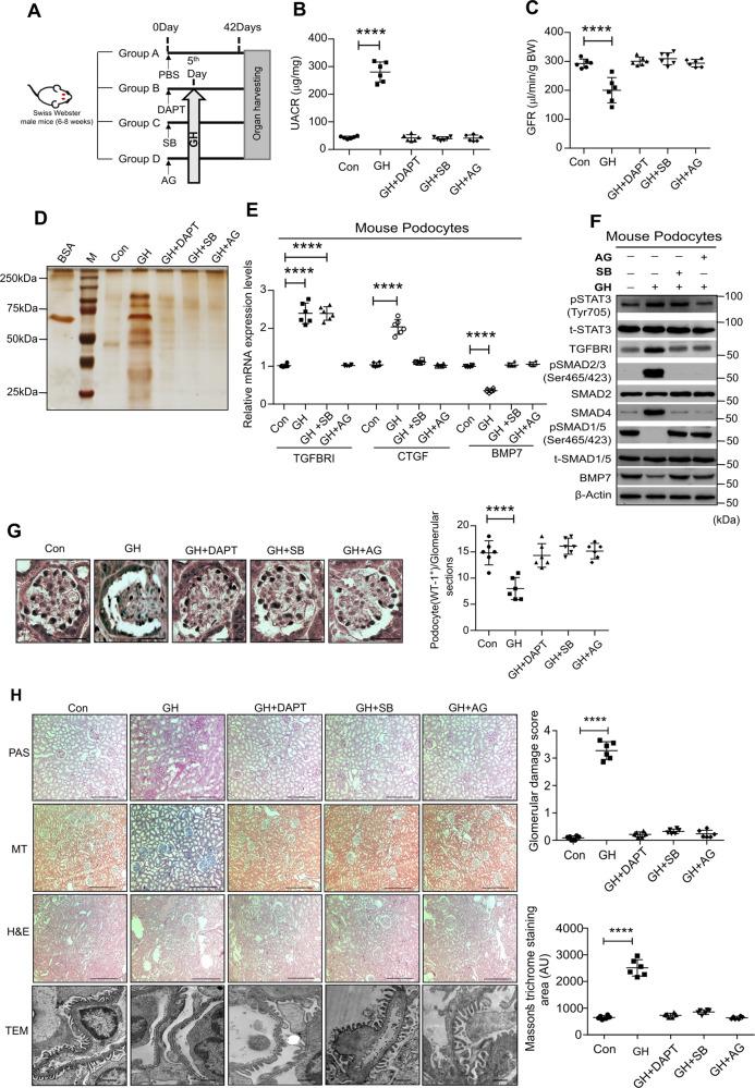 https://cdn.ncbi.nlm.nih.gov/pmc/blobs/94f3/8016968/5ff2f59fb2b4/41419_2021_3643_Fig5_HTML.jpg
