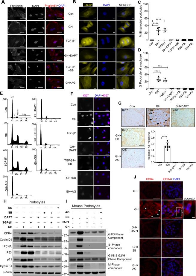 https://cdn.ncbi.nlm.nih.gov/pmc/blobs/94f3/8016968/954c2cffb14b/41419_2021_3643_Fig3_HTML.jpg