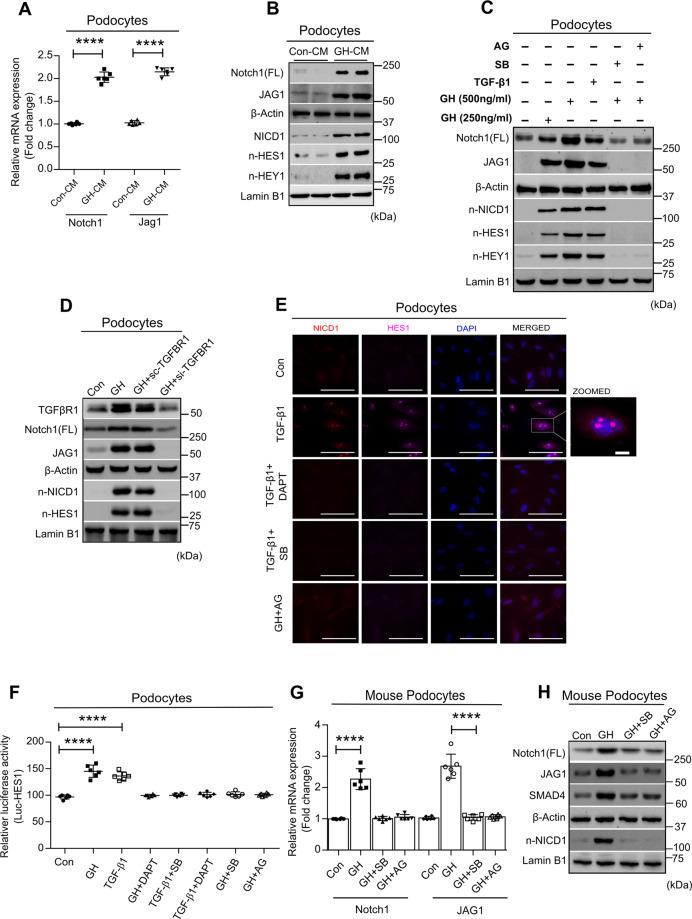 https://cdn.ncbi.nlm.nih.gov/pmc/blobs/94f3/8016968/e4919728a6db/41419_2021_3643_Fig2_HTML.jpg