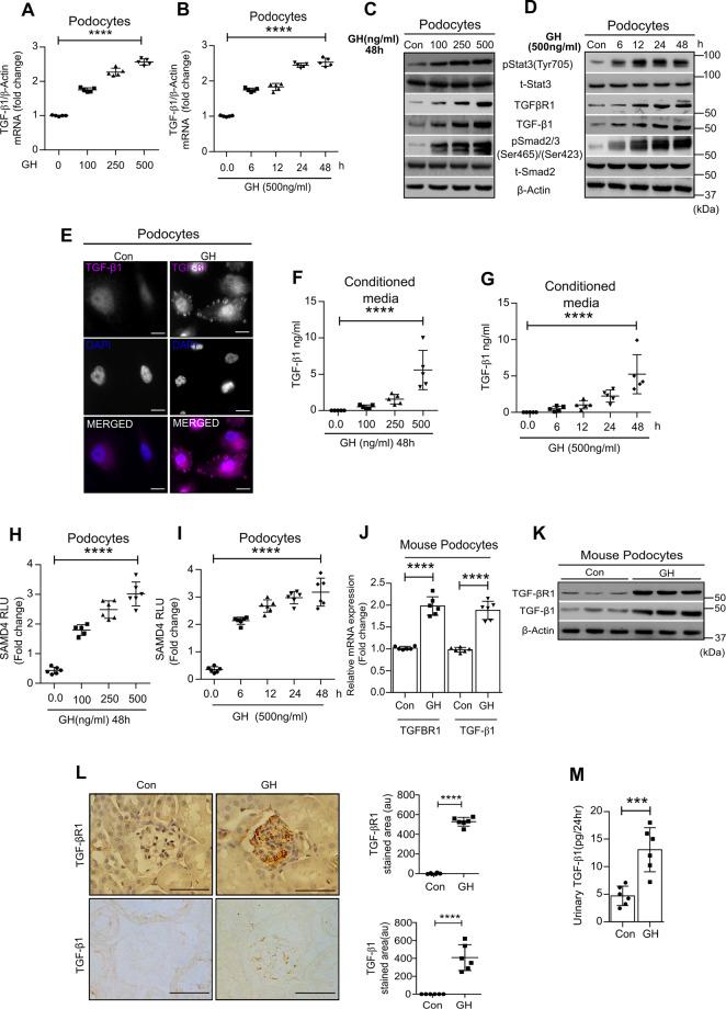 https://cdn.ncbi.nlm.nih.gov/pmc/blobs/94f3/8016968/fa53283175f6/41419_2021_3643_Fig1_HTML.jpg