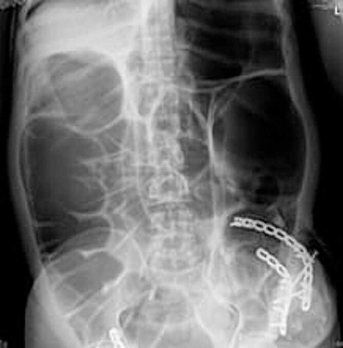 https://cdn.ncbi.nlm.nih.gov/pmc/blobs/94f8/11140507/17527a540868/rjae369f4.jpg