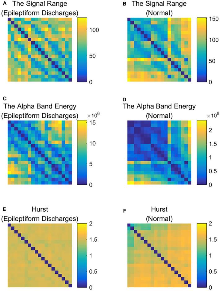 https://cdn.ncbi.nlm.nih.gov/pmc/blobs/94f8/7438848/33be5ecfeae2/fphys-11-00828-g0008.jpg
