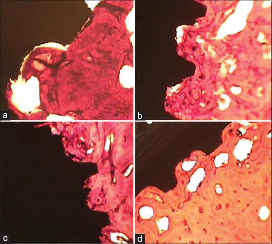 https://cdn.ncbi.nlm.nih.gov/pmc/blobs/9500/8351961/aa1091b35e5b/DRJ-18-43-g003.jpg