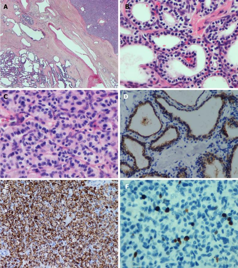 https://cdn.ncbi.nlm.nih.gov/pmc/blobs/9501/6906574/627b6aad5e85/WJCC-7-4119-g003.jpg