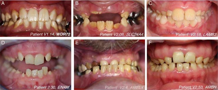 https://cdn.ncbi.nlm.nih.gov/pmc/blobs/9505/4752661/3a160a08ebee/jmedgenet-2015-103302f03.jpg