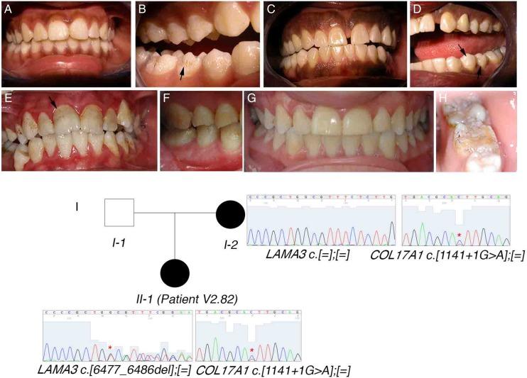 https://cdn.ncbi.nlm.nih.gov/pmc/blobs/9505/4752661/eee9865e681b/jmedgenet-2015-103302f02.jpg