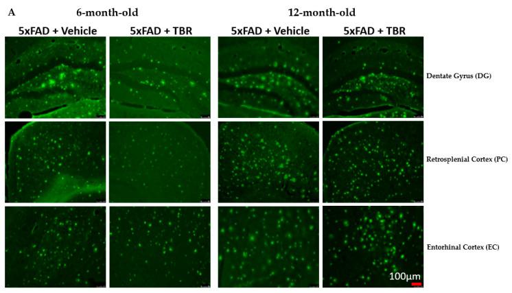 https://cdn.ncbi.nlm.nih.gov/pmc/blobs/950f/8615742/b36fd7b48f3a/brainsci-11-01423-g010a.jpg