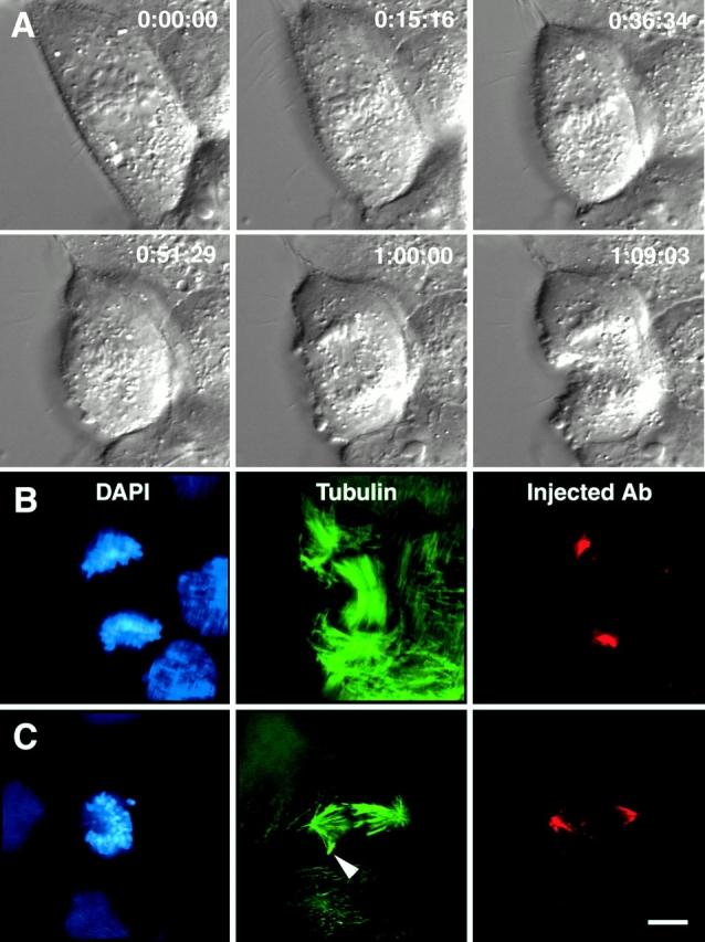 https://cdn.ncbi.nlm.nih.gov/pmc/blobs/9513/2196006/353201dd4eec/JCB0010009.f2.jpg