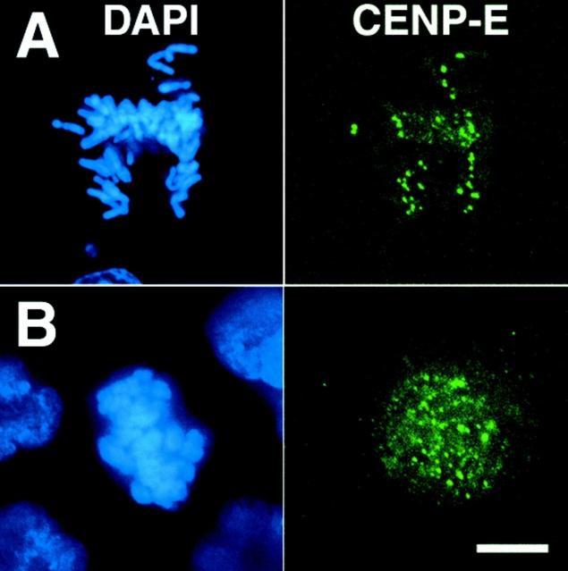 https://cdn.ncbi.nlm.nih.gov/pmc/blobs/9513/2196006/8920705d55ec/JCB0010009.f6.jpg