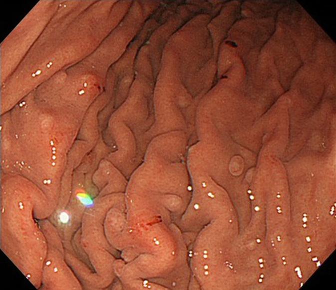 https://cdn.ncbi.nlm.nih.gov/pmc/blobs/9514/6346784/9f581b0bf6fc/607_Fig2.jpg